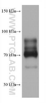 PIAS1 Antibody in Western Blot (WB)
