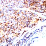 CD158b Antibody in Immunohistochemistry (Paraffin) (IHC (P))