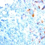 CD26 Antibody in Immunohistochemistry (Paraffin) (IHC (P))