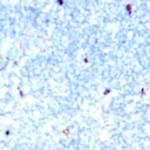 CD80 Antibody in Immunohistochemistry (Paraffin) (IHC (P))
