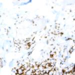 CD81 (TAPA-1) Antibody in Immunohistochemistry (Paraffin) (IHC (P))