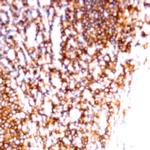 CD99 Antibody in Immunohistochemistry (Paraffin) (IHC (P))
