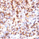 TCRa/b Antibody in Immunohistochemistry (Paraffin) (IHC (P))