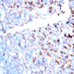 CD11a Antibody in Immunohistochemistry (Paraffin) (IHC (P))