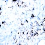 CD123 Antibody in Immunohistochemistry (Paraffin) (IHC (P))