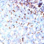 CD161 Antibody in Immunohistochemistry (Paraffin) (IHC (P))