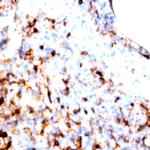 CD1a Antibody in Immunohistochemistry (Paraffin) (IHC (P))