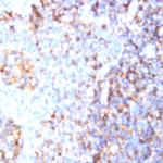 CD200 Antibody in Immunohistochemistry (Paraffin) (IHC (P))