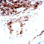 CD23 Antibody in Immunohistochemistry (Paraffin) (IHC (P))