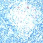 CD52 Antibody in Immunohistochemistry (Paraffin) (IHC (P))