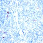 CD52 Antibody in Immunohistochemistry (Paraffin) (IHC (P))