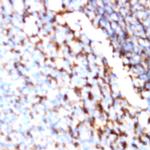 CD56 Antibody in Immunohistochemistry (Paraffin) (IHC (P))