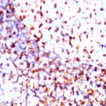 CD21 Antibody in Immunohistochemistry (Paraffin) (IHC (P))