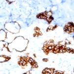 Cytokeratin (Pan) Antibody in Immunohistochemistry (Paraffin) (IHC (P))