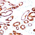 Cytokeratin (HMW) Antibody in Immunohistochemistry (Paraffin) (IHC (P))