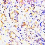 BCL-2 Antibody in Immunohistochemistry (Paraffin) (IHC (P))