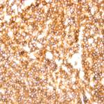 CD20 Antibody in Immunohistochemistry (Paraffin) (IHC (P))