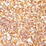 CD20 Antibody in Immunohistochemistry (Paraffin) (IHC (P))