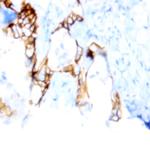 CD64 Antibody in Immunohistochemistry (Paraffin) (IHC (P))