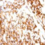 CD9 Antibody in Immunohistochemistry (Paraffin) (IHC (P))