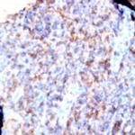 HLA-DR Antibody in Immunohistochemistry (Paraffin) (IHC (P))