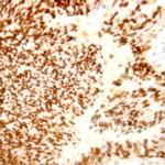 BCL-X Antibody in Immunohistochemistry (Paraffin) (IHC (P))