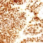 BCL-XL Antibody in Immunohistochemistry (Paraffin) (IHC (P))