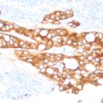 Catenin beta Antibody in Immunohistochemistry (Paraffin) (IHC (P))