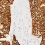 Cadherin 17 Antibody in Immunohistochemistry (Paraffin) (IHC (P))
