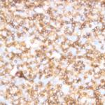 CD122 Antibody in Immunohistochemistry (Paraffin) (IHC (P))