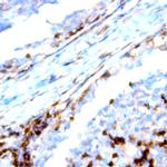 CD195/CCR5 Antibody in Immunohistochemistry (Paraffin) (IHC (P))