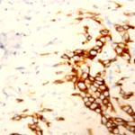 Cytokeratin 6 Antibody in Immunohistochemistry (Paraffin) (IHC (P))
