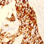 Cytokeratin 6 Antibody in Immunohistochemistry (Paraffin) (IHC (P))