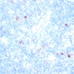 CD49 Antibody in Immunohistochemistry (Paraffin) (IHC (P))