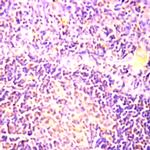 CD75 Antibody in Immunohistochemistry (Paraffin) (IHC (P))