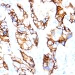 E-Cadherin Antibody in Immunohistochemistry (Paraffin) (IHC (P))