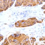 Desmoglein 2 Antibody in Immunohistochemistry (Paraffin) (IHC (P))
