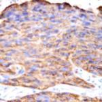 Epha 3 Antibody in Immunohistochemistry (Paraffin) (IHC (P))