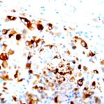 FLI-1 Antibody in Immunohistochemistry (Paraffin) (IHC (P))