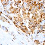 Her2 Antibody in Immunohistochemistry (Paraffin) (IHC (P))