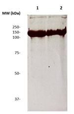 Human IgG4 Antibody in Western Blot (WB)