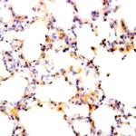INCENP Antibody in Immunohistochemistry (Paraffin) (IHC (P))