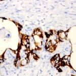 Integrin Beta 1 Antibody in Immunohistochemistry (Paraffin) (IHC (P))