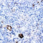 MUC5 Antibody in Immunohistochemistry (Paraffin) (IHC (P))