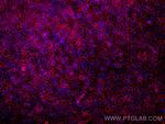 CD47 Antibody in Immunocytochemistry (ICC/IF)