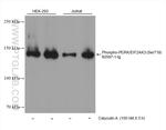 Cleaved PARP1 Antibody in Western Blot (WB)
