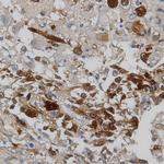 MAGE1 Antibody in Immunohistochemistry (Paraffin) (IHC (P))