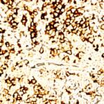Myeloid Marker Antibody in Immunohistochemistry (Paraffin) (IHC (P))