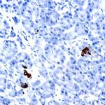 Napsin A Antibody in Immunohistochemistry (Paraffin) (IHC (P))