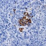 NK-1 Antibody in Immunohistochemistry (Paraffin) (IHC (P))